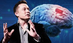 'Beynimize çip takacak' denilen Musk'tan şok karar!